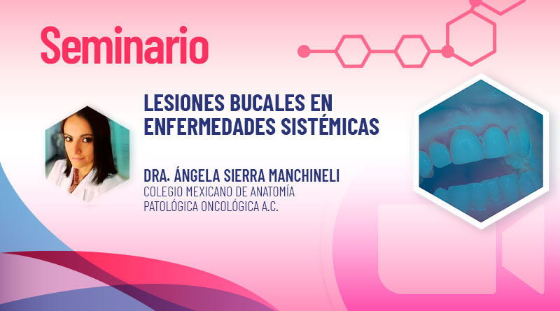 Evento_300125
