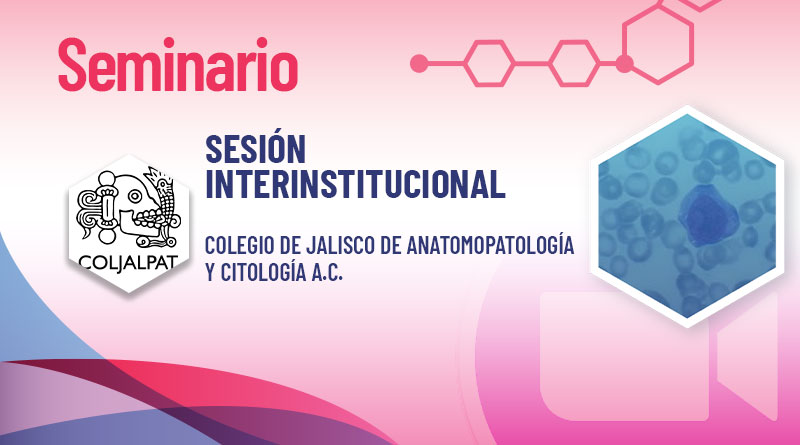 Evento_260625